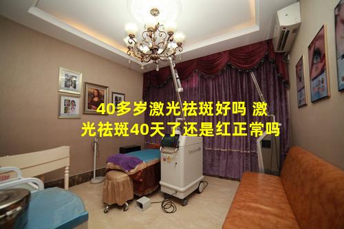 40多岁激光祛斑好吗 激光祛斑40天了还是红正常吗